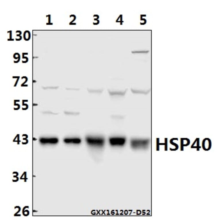 Anti-HSP40 (P303) Antibody from Bioworld Technology (BS1178) - Antibodies.com