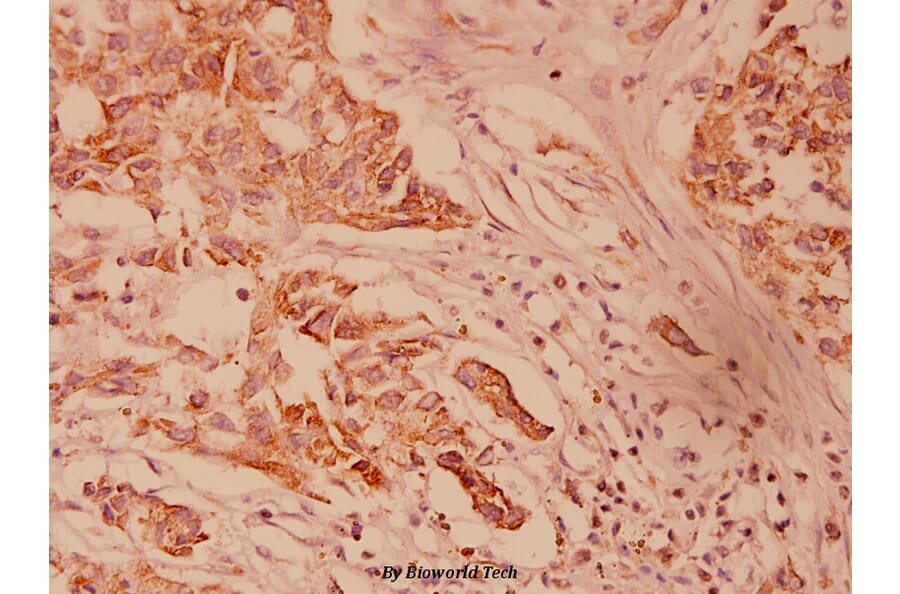 Anti-HSP40 (P303) Antibody from Bioworld Technology (BS1178) - Antibodies.com