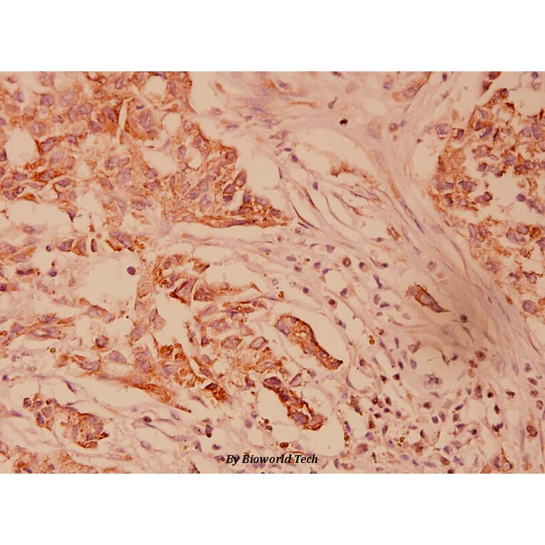 Anti-HSP40 (P303) Antibody from Bioworld Technology (BS1178) - Antibodies.com