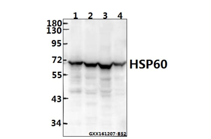 Anti-HSP60 (T547) Antibody from Bioworld Technology (BS1179) - Antibodies.com