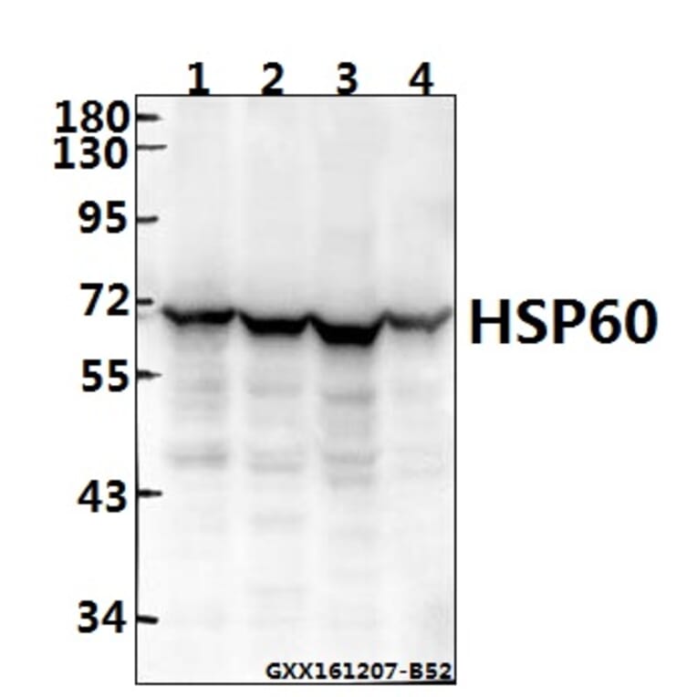Anti-HSP60 (T547) Antibody from Bioworld Technology (BS1179) - Antibodies.com