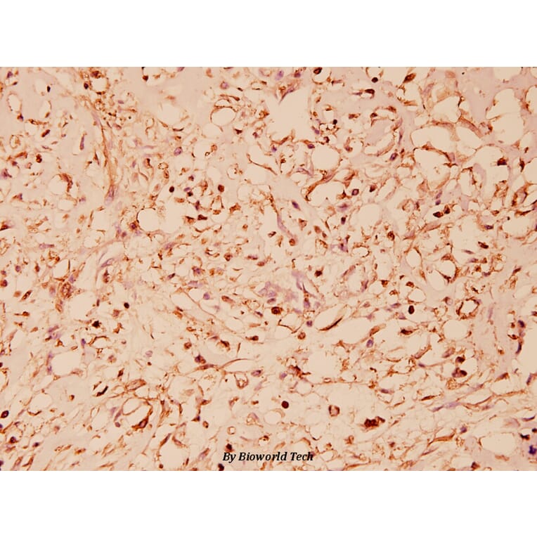 Anti-HSP60 (T547) Antibody from Bioworld Technology (BS1179) - Antibodies.com