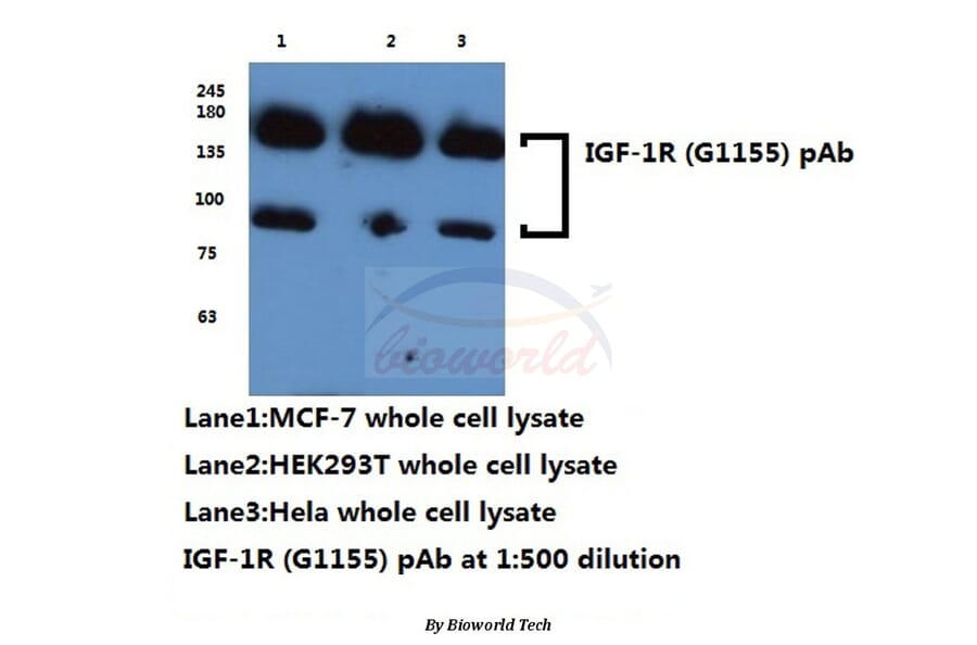 Anti-IGF-1R (G1155) Antibody from Bioworld Technology (BS1182) - Antibodies.com