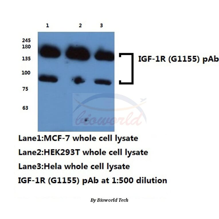 Anti-IGF-1R (G1155) Antibody from Bioworld Technology (BS1182) - Antibodies.com