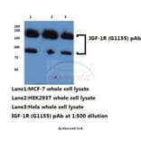 Anti-IGF-1R (G1155) Antibody from Bioworld Technology (BS1182) - Antibodies.com
