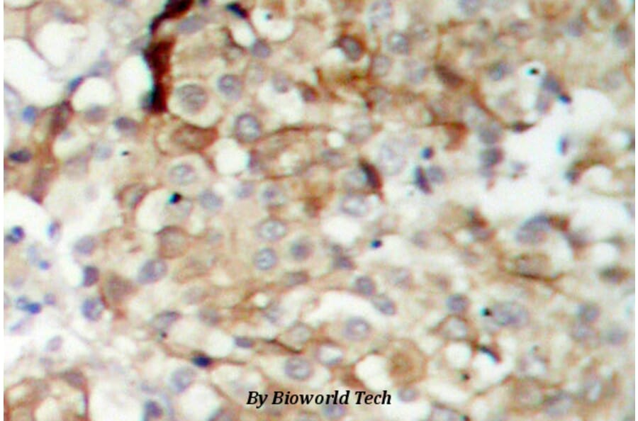 Anti-IGF-1R (G1155) Antibody from Bioworld Technology (BS1182) - Antibodies.com