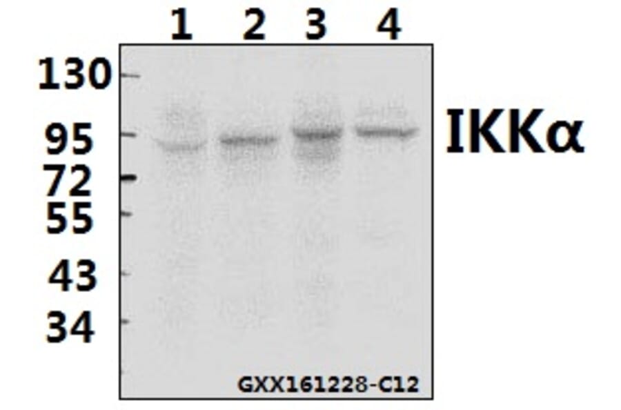 Anti-IKKα (M17) Antibody from Bioworld Technology (BS1184) - Antibodies.com