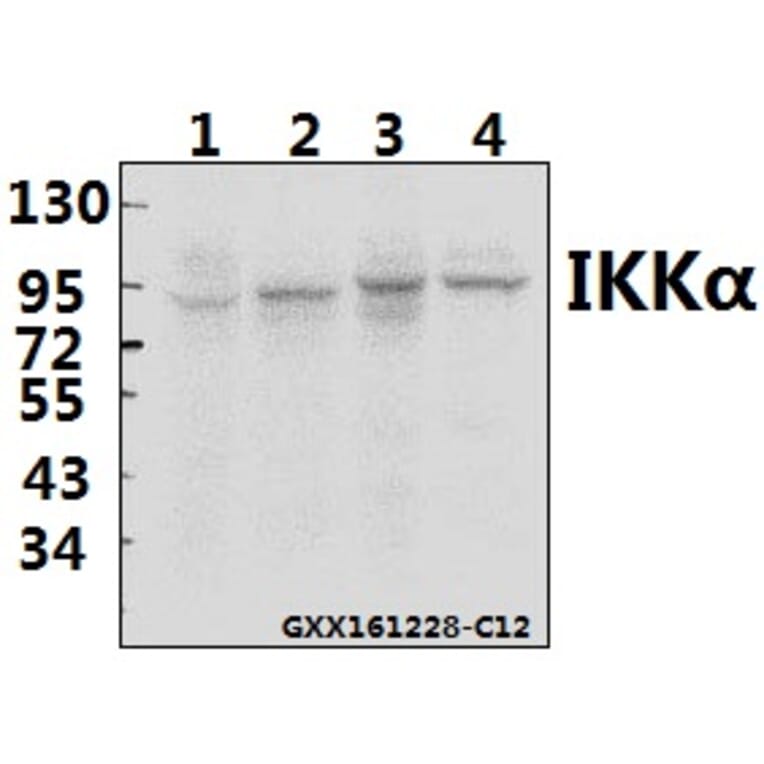 Anti-IKKα (M17) Antibody from Bioworld Technology (BS1184) - Antibodies.com