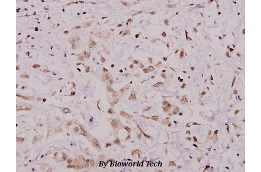 Anti-IKKα (M17) Antibody from Bioworld Technology (BS1184) - Antibodies.com