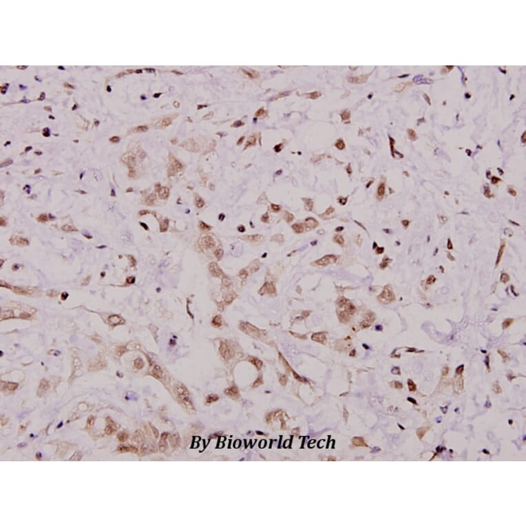 Anti-IKKα (M17) Antibody from Bioworld Technology (BS1184) - Antibodies.com