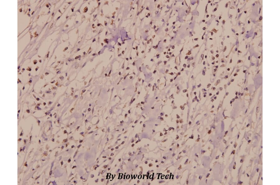 Anti-IL-3Rβ (F587) Antibody from Bioworld Technology (BS1185) - Antibodies.com