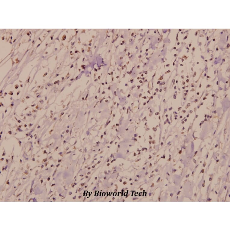Anti-IL-3Rβ (F587) Antibody from Bioworld Technology (BS1185) - Antibodies.com