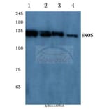 Anti-NOS2 (V1131) Antibody from Bioworld Technology (BS1186) - Antibodies.com