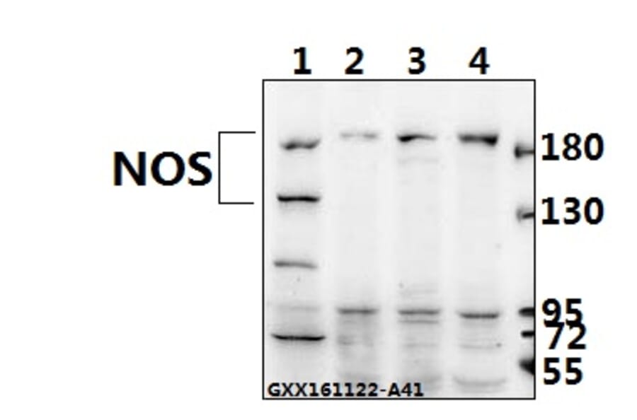 Anti-NOS2 (V1131) Antibody from Bioworld Technology (BS1186) - Antibodies.com