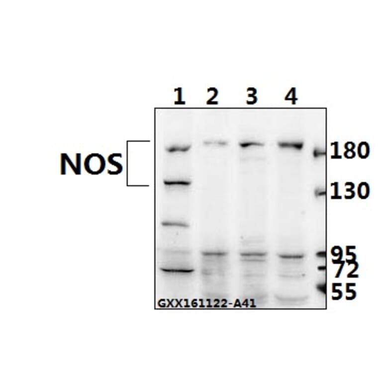 Anti-NOS2 (V1131) Antibody from Bioworld Technology (BS1186) - Antibodies.com