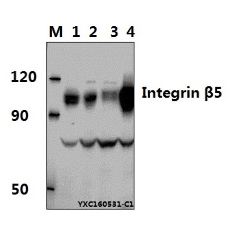 Anti-Integrin β5 (V746) Antibody from Bioworld Technology (BS1188) - Antibodies.com