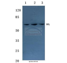 Anti-Involucrin (P568) Antibody from Bioworld Technology (BS1189) - Antibodies.com