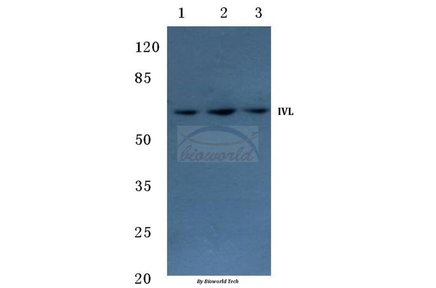 Anti-Involucrin (P568) Antibody from Bioworld Technology (BS1189) - Antibodies.com