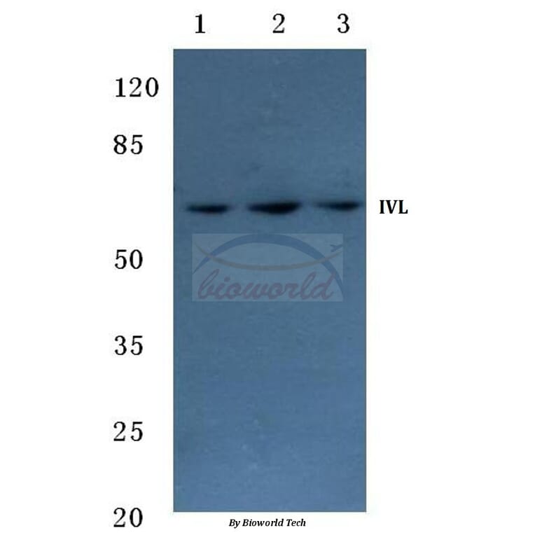 Anti-Involucrin (P568) Antibody from Bioworld Technology (BS1189) - Antibodies.com