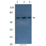 Anti-Involucrin (P568) Antibody from Bioworld Technology (BS1189) - Antibodies.com