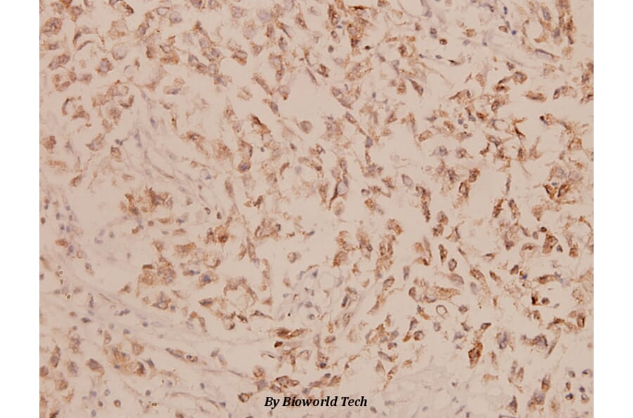 Anti-Involucrin (P568) Antibody from Bioworld Technology (BS1189) - Antibodies.com