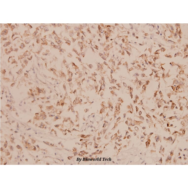 Anti-Involucrin (P568) Antibody from Bioworld Technology (BS1189) - Antibodies.com