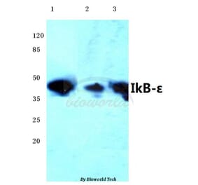 Anti-IKB-ε (D17) Antibody from Bioworld Technology (BS1191) - Antibodies.com