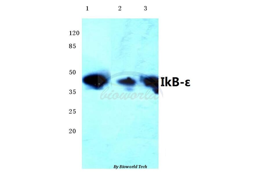 Anti-IKB-ε (D17) Antibody from Bioworld Technology (BS1191) - Antibodies.com