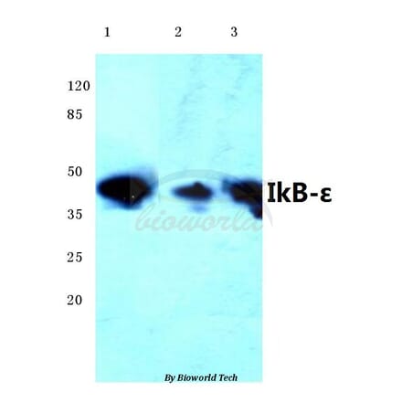 Anti-IKB-ε (D17) Antibody from Bioworld Technology (BS1191) - Antibodies.com