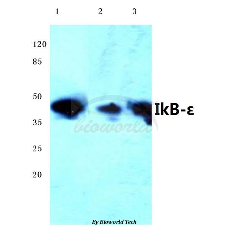 Anti-IKB-ε (D17) Antibody from Bioworld Technology (BS1191) - Antibodies.com