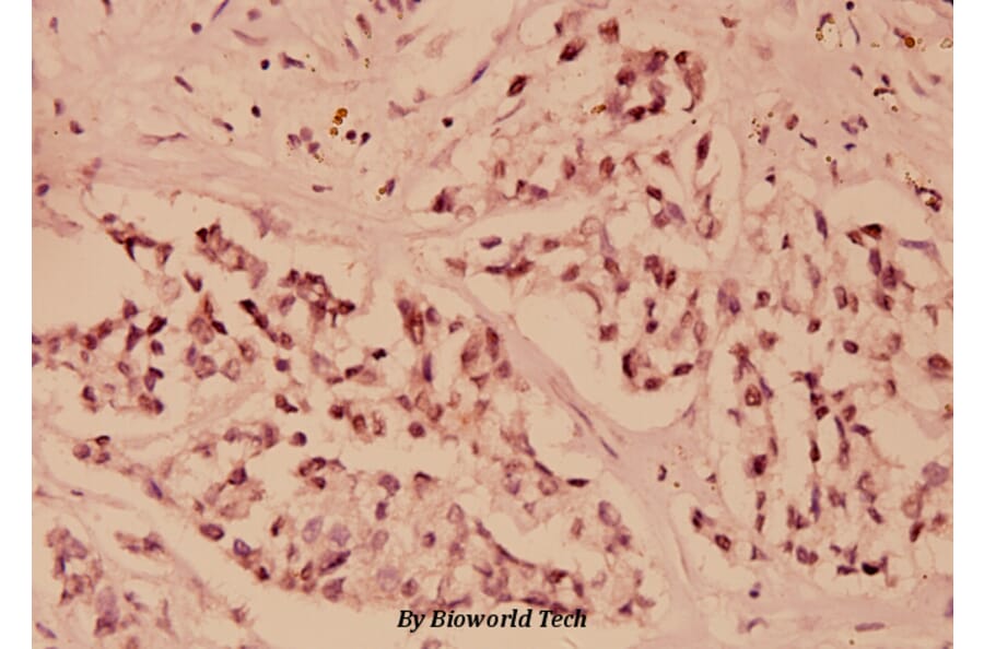 Anti-IKB-ε (D17) Antibody from Bioworld Technology (BS1191) - Antibodies.com