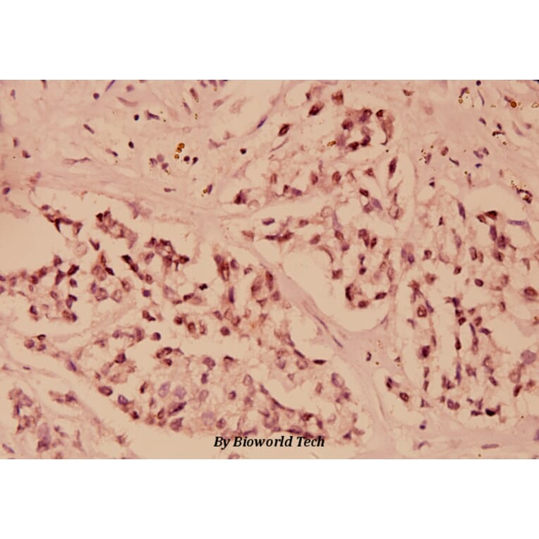 Anti-IKB-ε (D17) Antibody from Bioworld Technology (BS1191) - Antibodies.com