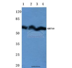 Anti-Cytokeratin 10 (Y160) Antibody from Bioworld Technology (BS1199) - Antibodies.com