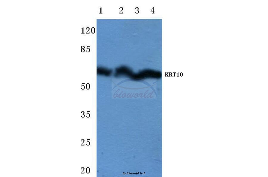 Anti-Cytokeratin 10 (Y160) Antibody from Bioworld Technology (BS1199) - Antibodies.com