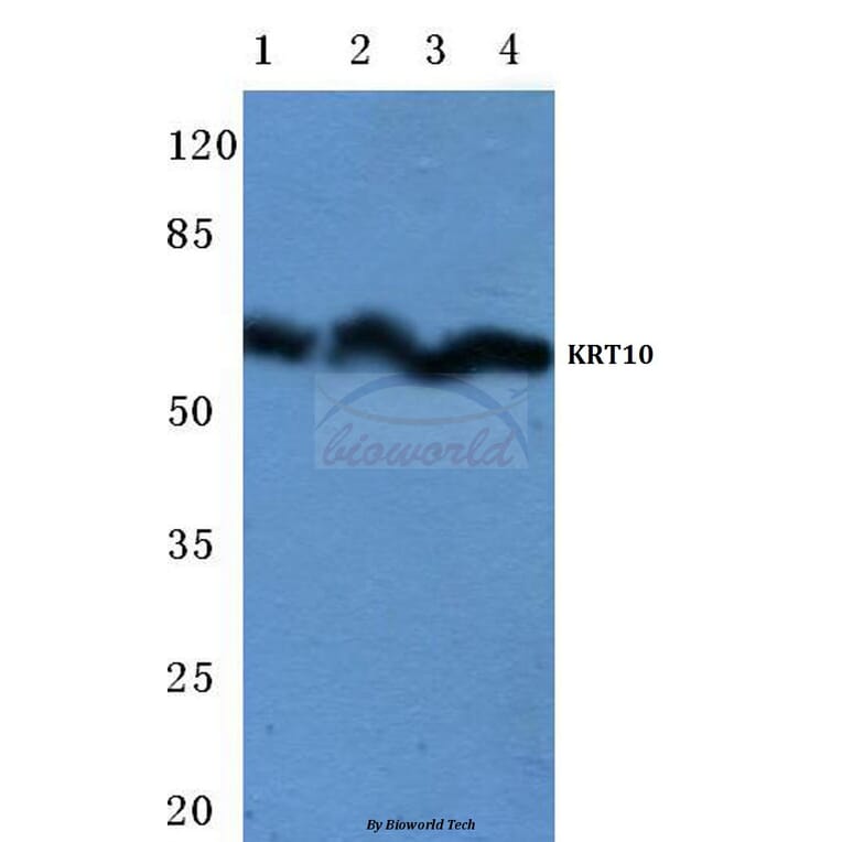 Anti-Cytokeratin 10 (Y160) Antibody from Bioworld Technology (BS1199) - Antibodies.com