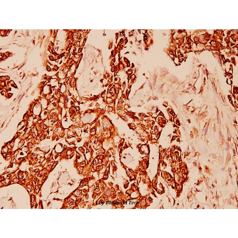 Anti-Cytokeratin 10 (Y160) Antibody from Bioworld Technology (BS1199) - Antibodies.com