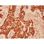 Anti-Cytokeratin 10 (Y160) Antibody from Bioworld Technology (BS1199) - Antibodies.com