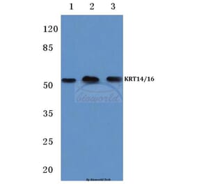 Anti-Cytokeratin 14/16 (S5) Antibody from Bioworld Technology (BS1200) - Antibodies.com