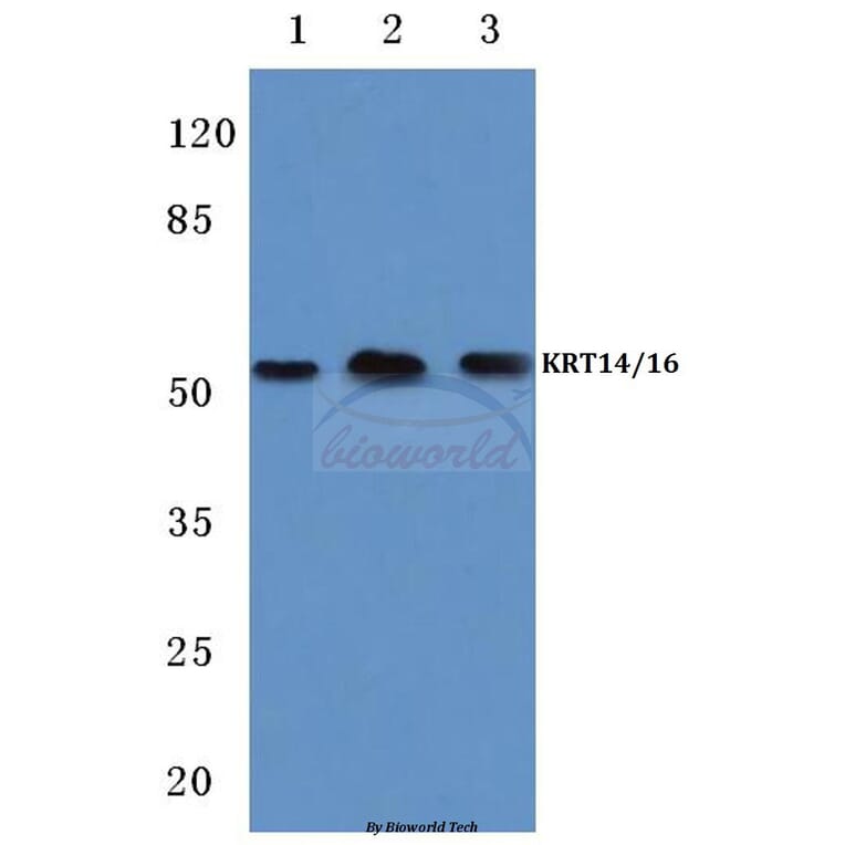 Anti-Cytokeratin 14/16 (S5) Antibody from Bioworld Technology (BS1200) - Antibodies.com