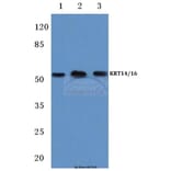 Anti-Cytokeratin 14/16 (S5) Antibody from Bioworld Technology (BS1200) - Antibodies.com
