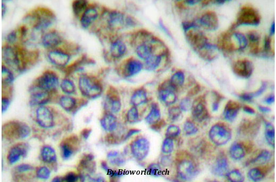 Anti-Cytokeratin 14/16 (S5) Antibody from Bioworld Technology (BS1200) - Antibodies.com