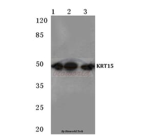 Anti-Cytokeratin 15 (T12) Antibody from Bioworld Technology (BS1201) - Antibodies.com