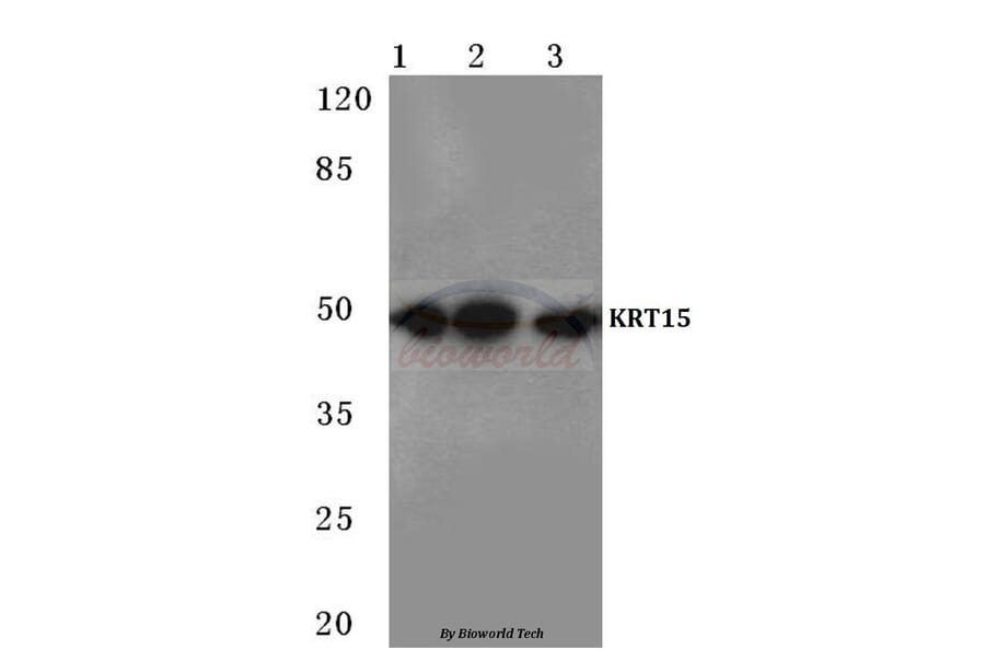 Anti-Cytokeratin 15 (T12) Antibody from Bioworld Technology (BS1201) - Antibodies.com