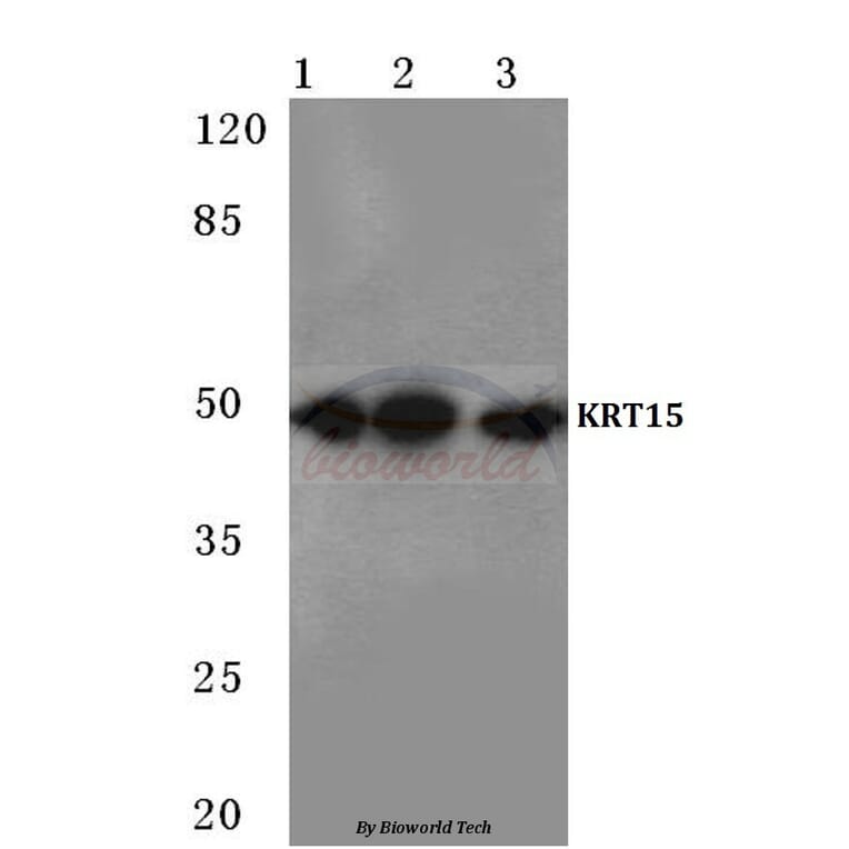 Anti-Cytokeratin 15 (T12) Antibody from Bioworld Technology (BS1201) - Antibodies.com