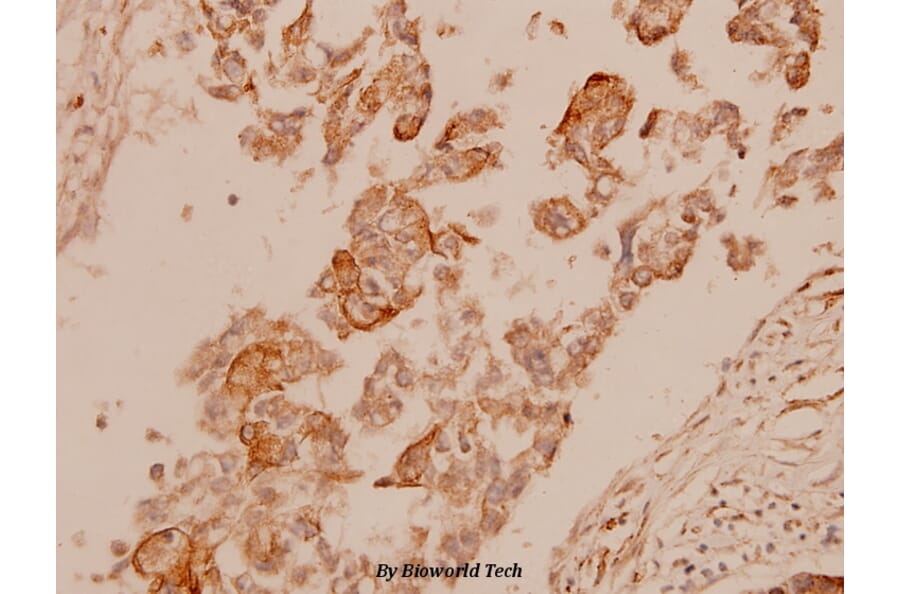 Anti-Cytokeratin 15 (T12) Antibody from Bioworld Technology (BS1201) - Antibodies.com