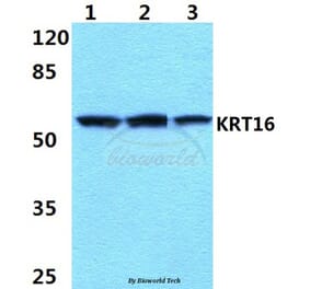 Anti-Cytokeratin 16 (S451) Antibody from Bioworld Technology (BS1202) - Antibodies.com