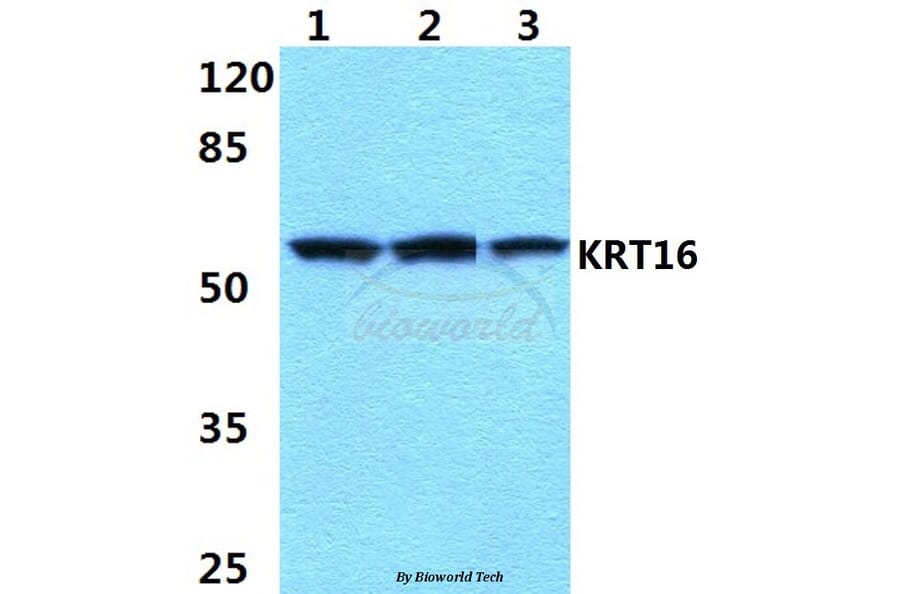 Anti-Cytokeratin 16 (S451) Antibody from Bioworld Technology (BS1202) - Antibodies.com