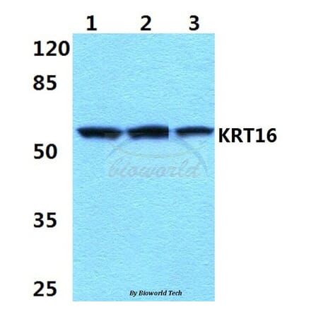 Anti-Cytokeratin 16 (S451) Antibody from Bioworld Technology (BS1202) - Antibodies.com