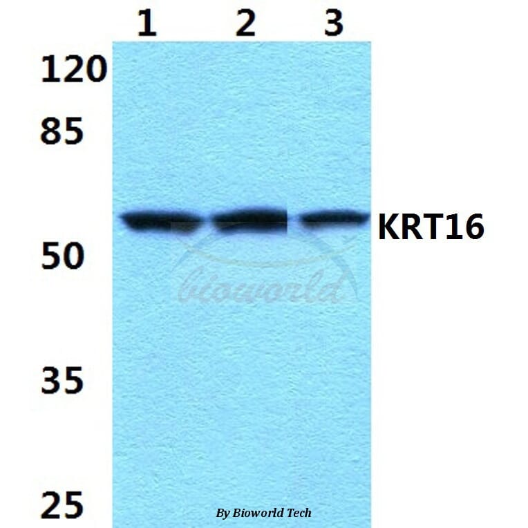 Anti-Cytokeratin 16 (S451) Antibody from Bioworld Technology (BS1202) - Antibodies.com