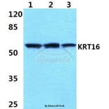 Anti-Cytokeratin 16 (S451) Antibody from Bioworld Technology (BS1202) - Antibodies.com